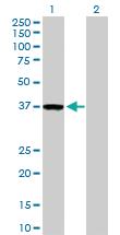 Anti-ZWINT Rabbit Polyclonal Antibody