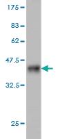 Anti-NEK4 Mouse Monoclonal Antibody [clone: 2E9]