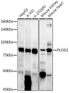 Western blot analysis of extracts of various cell lines, using Anti-LH1 Antibody (A10250) at 1:1,000 dilution