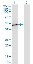 Anti-CPB1 Mouse Monoclonal Antibody [clone: 4D5]