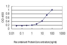 Anti-RBP4 Mouse Monoclonal Antibody [clone: 4D9]