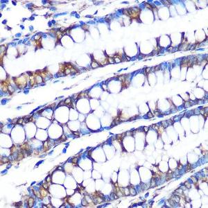 Immunohistochemistry analysis of paraffin-embedded human colon tissue using Anti-LOX Antibody [ARC0624] (A81177) at a dilution of 1:100 (40X lens). Perform microwave antigen retrieval with 10 mM PBS buffer pH 7.2 before commencing with IHC staining protocol