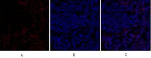 Immunofluorescence analysis of mouse lung tissue using Anti-Retinoblastoma Antibody (red) at 1:200 (4°C overnight) Cy3 labelled secondary antibody was used at 1:300 (RT 50min) Panel A: Target Panel B: DAPI Panel C: Merge