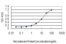 Anti-RBP4 Mouse Monoclonal Antibody [clone: 1A8]