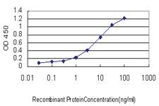 Anti-RORA Mouse Monoclonal Antibody [clone: 4E3]