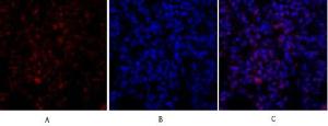 Immunofluorescence analysis of rat lung tissue using Anti-Retinoblastoma Antibody (red) at 1:200 (4°C overnight) Cy3 labelled secondary antibody was used at 1:300 (RT 50min) Panel A: Target Panel B: DAPI Panel C: Merge