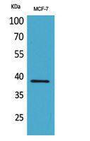 Anti-CER1 antibody