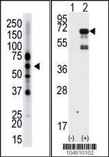 Anti-EPN2 Rabbit Polyclonal Antibody (HRP (Horseradish Peroxidase))