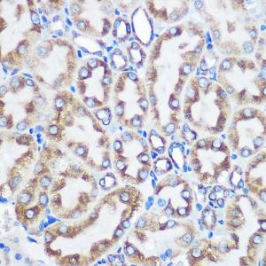 Immunohistochemistry analysis of paraffin-embedded rat kidney using Anti-LOX Antibody [ARC0624] (A81177) at a dilution of 1:100 (40X lens). Perform microwave antigen retrieval with 10 mM PBS buffer pH 7.2 before commencing with IHC staining protocol