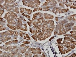 Anti-CPB1 Mouse Monoclonal Antibody [clone: 4D5]