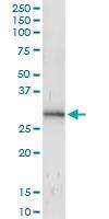 Anti-ING4 Polyclonal Antibody Pair