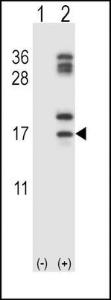 Anti-CLC Rabbit Polyclonal Antibody