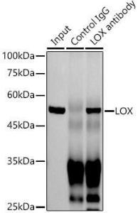 Immunoprecipitation analysis of 300 µg extracts of Jurkat cells using 3 µg of Anti-LOX Antibody [ARC0624] (A81177). This Western blot was performed on the immunoprecipitate using Anti-LOX Antibody [ARC0624] (A81177) at a dilution of 1:1000