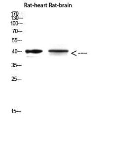 Anti-CER1 antibody