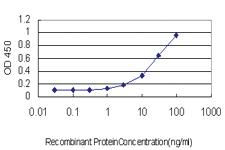 Anti-RBP4 Mouse Monoclonal Antibody [clone: 3D12]