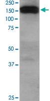 Anti-DCTN1 Goat Polyclonal Antibody