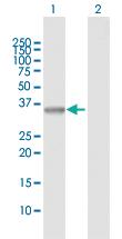 Anti-SGTA Rabbit Polyclonal Antibody