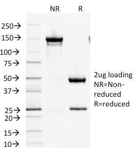 SDS-PAGE analysis of Anti-Factor XIIIa Antibody [F13A1/1447] under non-reduced and reduced conditions; showing intact IgG and intact heavy and light chains, respectively. SDS-PAGE analysis confirms the integrity and purity of the antibody