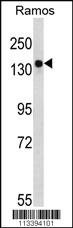 Anti-TSC2 Rabbit Polyclonal Antibody