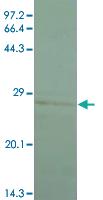 Anti-PTHLH Mouse Monoclonal Antibody [clone: 1D1]