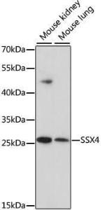 Western blot analysis of extracts of various cell lines, using Anti-SSX4 Antibody (A10252) at 1:1,000 dilution