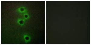 Immunofluorescence analysis of A549 cells using Anti-MARK4 Antibody. The right hand panel represents a negative control, where the antibody was pre-incubated with the immunising peptide.