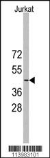 Anti-YBX2 Rabbit Polyclonal Antibody