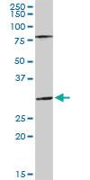 Anti-SGTA Rabbit Polyclonal Antibody