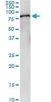 Anti-F2 Polyclonal Antibody Pair