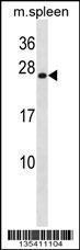 Anti-HOXB7 Rabbit Polyclonal Antibody