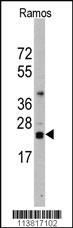 Anti-OTX2 Rabbit Polyclonal Antibody