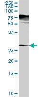 Anti-SGTA Rabbit Polyclonal Antibody