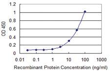 Anti-CAPN11 Mouse Monoclonal Antibody [clone: 2G2]