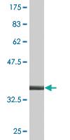 Anti-RAB1B Mouse Monoclonal Antibody [clone: 1B2]