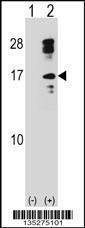 Anti-CLC Rabbit Polyclonal Antibody (AP (Alkaline Phosphatase))