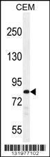 Anti-PCDHB3 Rabbit Polyclonal Antibody (HRP (Horseradish Peroxidase))