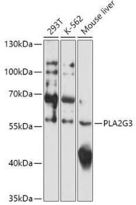 Western blot analysis of extracts of various cell lines, using Anti-PLA2G3 Antibody (A308477) at 1:1,000 dilution. The secondary antibody was Goat Anti-Rabbit IgG H&L Antibody (HRP) at 1:10,000 dilution.