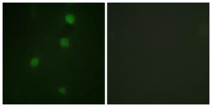 Immunofluorescence analysis of NIH/3T3 cells using Anti-Retinoblastoma Antibody. The right hand panel represents a negative control, where the antibody was pre-incubated with the immunising peptide.