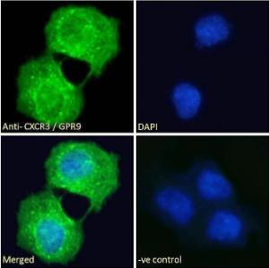 Anti-GPR9 Antibody (A121162) - Immunofluorescence analysis of paraformaldehyde fixed A431 cells, permeabilized with 0.15% Triton