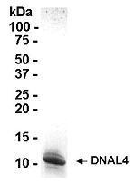 SDS PAGE: Analysis of DNAL4 Recombinant Protein. 4-20% SDS gradient gel. Coomassie blue staining.