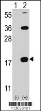 Anti-CD247 Rabbit Polyclonal Antibody