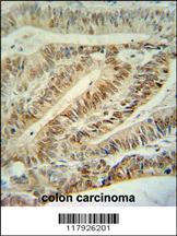 Anti-CUL5 Rabbit Polyclonal Antibody