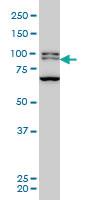 Anti-BRD3 Mouse Monoclonal Antibody [clone: 6C10]