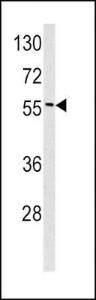 Anti-EPN3 Rabbit Polyclonal Antibody