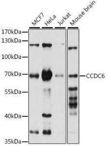 Western blot analysis of extracts of various cell lines, using Anti-CCDC6 Antibody (A308478) at 1:1,000 dilution. The secondary antibody was Goat Anti-Rabbit IgG H&L Antibody (HRP) at 1:10,000 dilution.