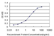 Anti-RORB Mouse Monoclonal Antibody [clone: 1D1]