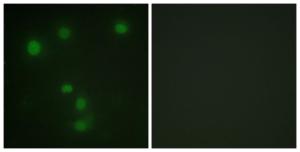 Immunofluorescence analysis of HUVEC cells using Anti-Retinoblastoma Antibody. The right hand panel represents a negative control, where the Antibody was pre-incubated with the immunising peptide