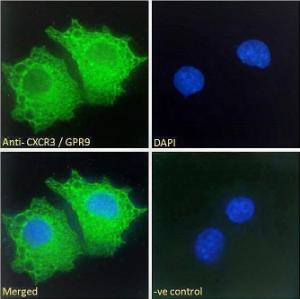 Anti-GPR9 Antibody (A121162) - Immunofluorescence analysis of paraformaldehyde fixed HepG2 cells, permeabilized with 0.15% Triton