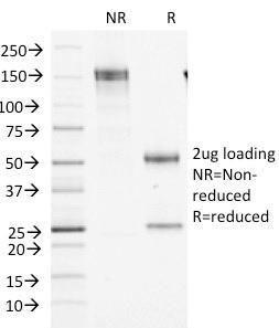 SDS-PAGE analysis of Anti-Factor XIIIa Antibody [F13A1/1448] under non-reduced and reduced conditions; showing intact IgG and intact heavy and light chains, respectively. SDS-PAGE analysis confirms the integrity and purity of the Antibody