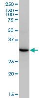 Anti-ESD Mouse Monoclonal Antibody [clone: 1E1]